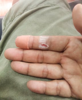 plaster on lesion finger for first aid concept photo