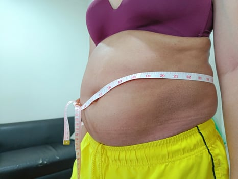 front view. shabby fat Asian woman standing showing her belly. You need to take care of your health and exercise. photo