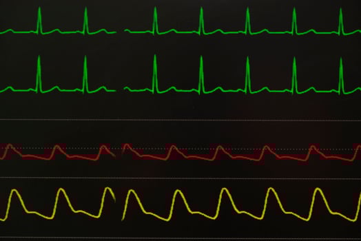 Monitoring displays of patient vital signs photo