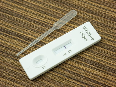 The  Antigen Test Kit for test corona virus  top view image photo