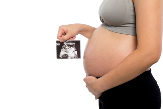 Closeup of a pregnant woman holding ultrasound picture on white background photo