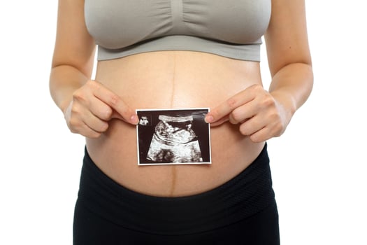 Closeup of a pregnant woman holding ultrasound picture on white background photo