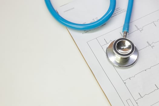 Blue stethoscopes and  Electrocardiography  chart close up image. photo