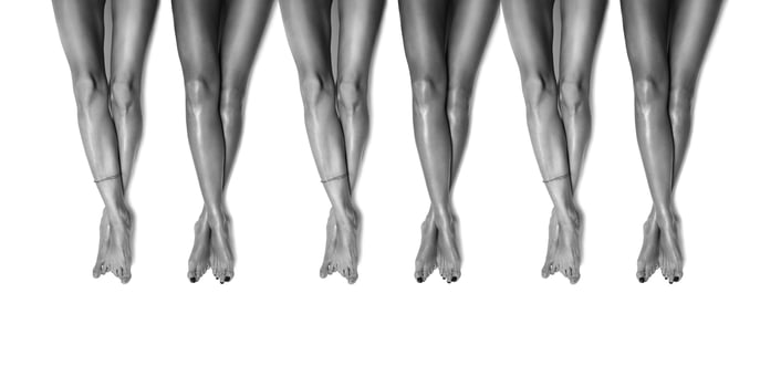 Group of beautiful, smooth women's legs after laser hair removal. Treatment, technology concept photo