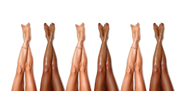 Group of beautiful, smooth diversity women's legs after laser hair removal. Treatment, technology concept photo