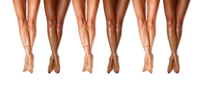 Group of beautiful, smooth diversity women's legs after laser hair removal. Treatment, technology concept photo