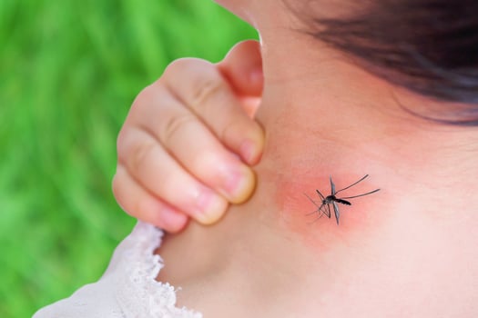 cute asian baby girl has rash and allergy on neck skin from mosquito bite and sucking blood while playing outdoor photo
