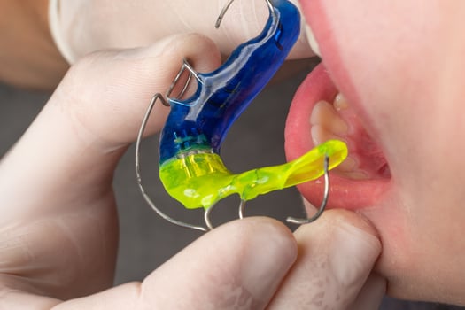Plate for the lower teeth, orthodontic and plate for the teeth of the lower jaw. photo