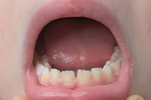 Jaw with children's straight teeth close-up. photo