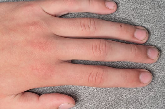 Dirty and long nails with burrs, fingers and fingernails of a child on a gray background. photo