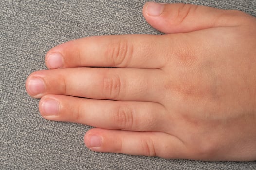 Child's dirty and sloppily cut nails, fingers and toenails close-up. photo