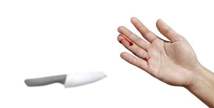 Bloody female hand and knife represents an injury accident on a white background photo