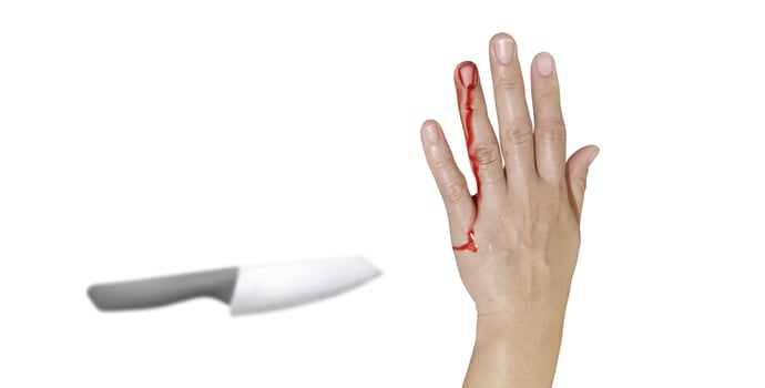 Bloody female hand and knife represents an injury accident on a white background photo