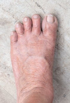 Top down view left foot of elderly woman photo