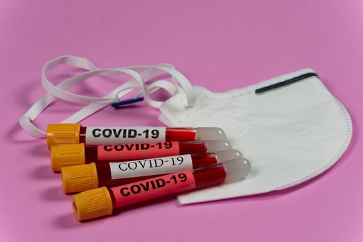 vacuum tube with blood and the word covid-19 on the identification tag. photo