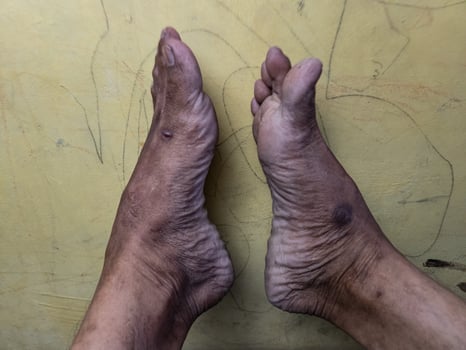 Foot photo, taken with a detailed position with a natural skin tone texture photo