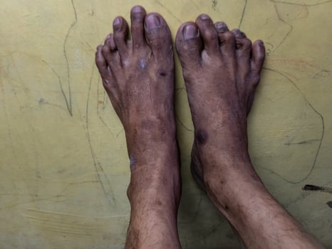 Foot photo, taken with a detailed position with a natural skin tone texture photo