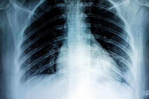 Film X-ray black and white photo