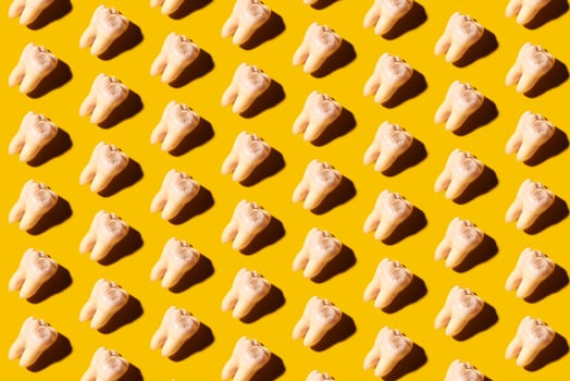 Lots of wisdom teeth with tooth decay, yellow background photo