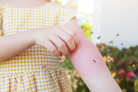 Little girl has skin rash allergy and itchy on her arm from mosquito bite photo