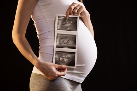 Ultrasound pregnancy view photo
