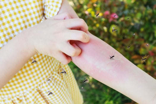 Little girl has skin rash allergy and itchy on her arm from mosquito bite photo