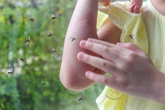 Little girl has skin rash allergy and itchy on her arm from mosquito bite photo