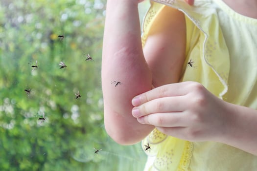Little girl has skin rash allergy and itchy on her arm from mosquito bite photo