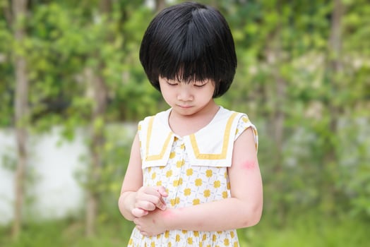 Little girl has skin rash allergy itching and scratching on her arm photo