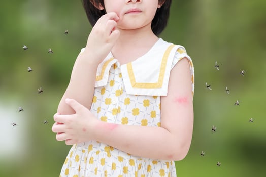 Little girl has skin rash allergy itching and scratching on her arm with mosquitoes bite photo