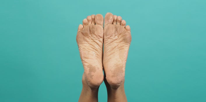 Close up of Foot peeling or remove dead skin on green or tiffany blue background. photo