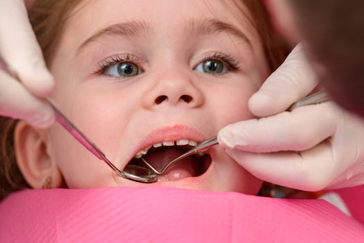 The dentist examines the baby girl's baby teeth, the treatment of baby teeth, the dentist holds a mirror. photo
