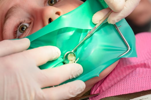 The dentist treats the child's tooth using a rubber dam. photo