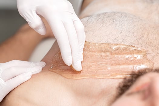 Epilation chest of young male photo
