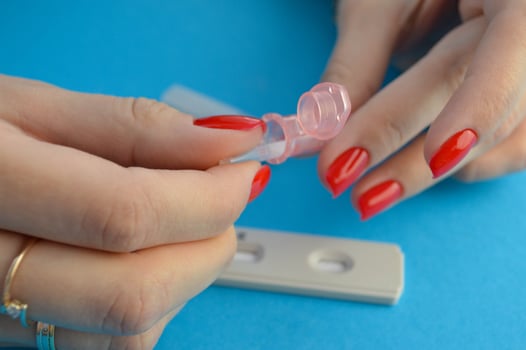Medicine and health concept. The doctor holds in his hands a test tube with blood tests for the virus -FSH photo