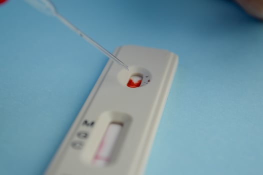 test for coronavirus on a blue background. girl with a bright red manicure makes a blood test. she adds a physical solution to a drop of blood for correct results photo