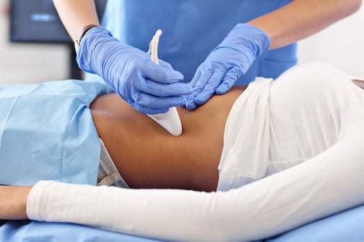 Adult woman having abdomen ultrasound tests at female doctor's office photo