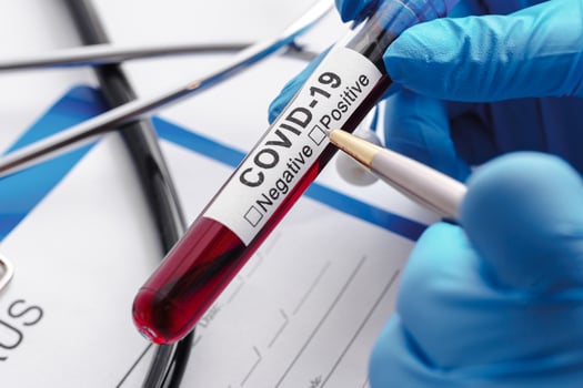 Scientist hand with a blood sample of COVID-19 photo