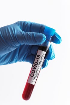 Scientist hand with a blood sample of COVID-19 photo