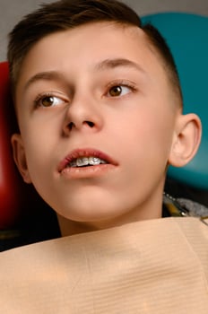 stretching rubber bands on braces. photo
