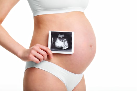 Close up of pregnant woman holding ultrasound scan on her tummy photo