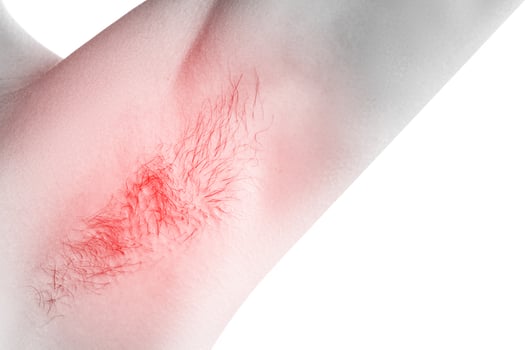 Closeup of female armpit. Concept of hygiene and hair removal. photo