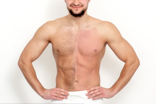 Man with bare-chested before and after waxing hair photo