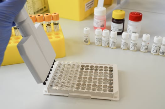 Woman with lab flask at her workplace stock photo