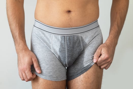 Man with wet briefs because of urinary incontinence photo