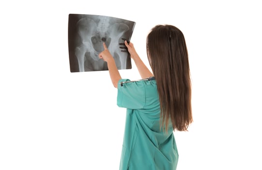 Young female doctor looking at the x-ray picture. isolated on white photo