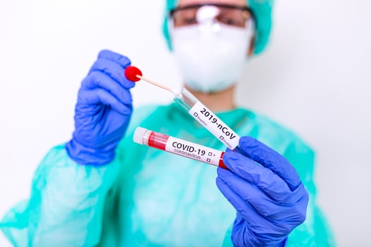 COVID-19 Nasal swab laboratory test in hospital lab, Nurse holding test tube with blood for 2019-nCoV analyzing. Novel Chinese Coronavirus blood test Concept. photo