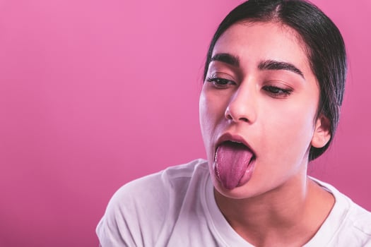 funny female model over white background crosses eyes and makes fish lips funny grimace photo
