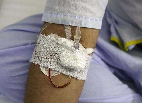 Via in patient's hand photo