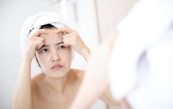 Problem skin. Concerned young asian women popping pimple on cheek while standing near mirror in bathroom. young asian women with acne photo